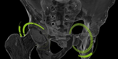 Pelvis bone - Healthcare private equity firms - Permira