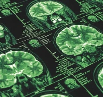 The image shows multiple cross-sectional scans of a brain, revealing its intricate structure and details in shades of green